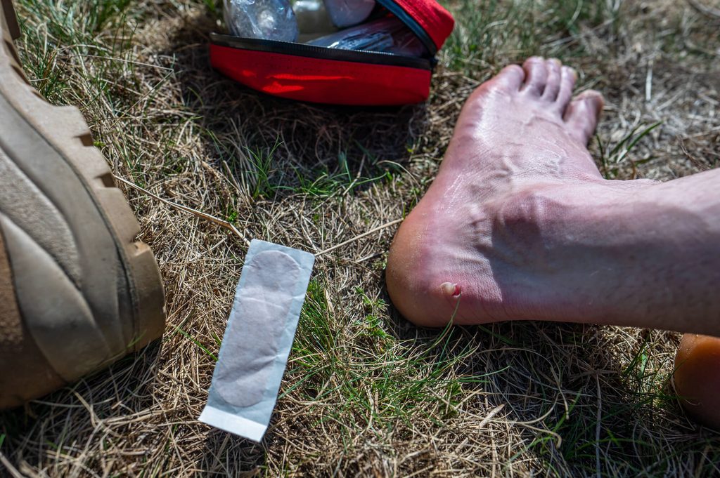 Blaren voorkomen tijdens het wandelen 2 Voet met een blaar op de hiel naast een open rode verbanddoos en een blisterpleister
